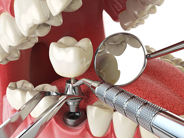 Best Walk-In Emergency Dentist in Dousman, WI